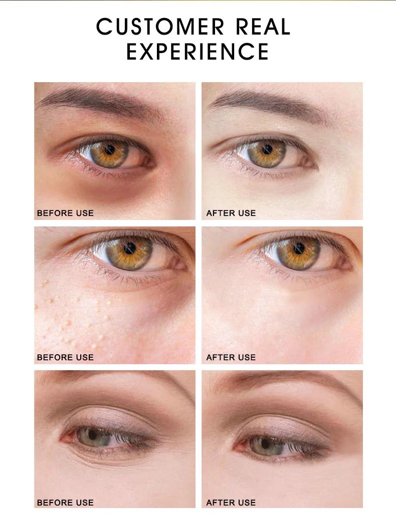 ARTISCARE Snail Face Cream + Peptide Eye Roller + Golden Eye Cream 3Pcs for Facial Moisturizing Serum Dark Circles Eye Care