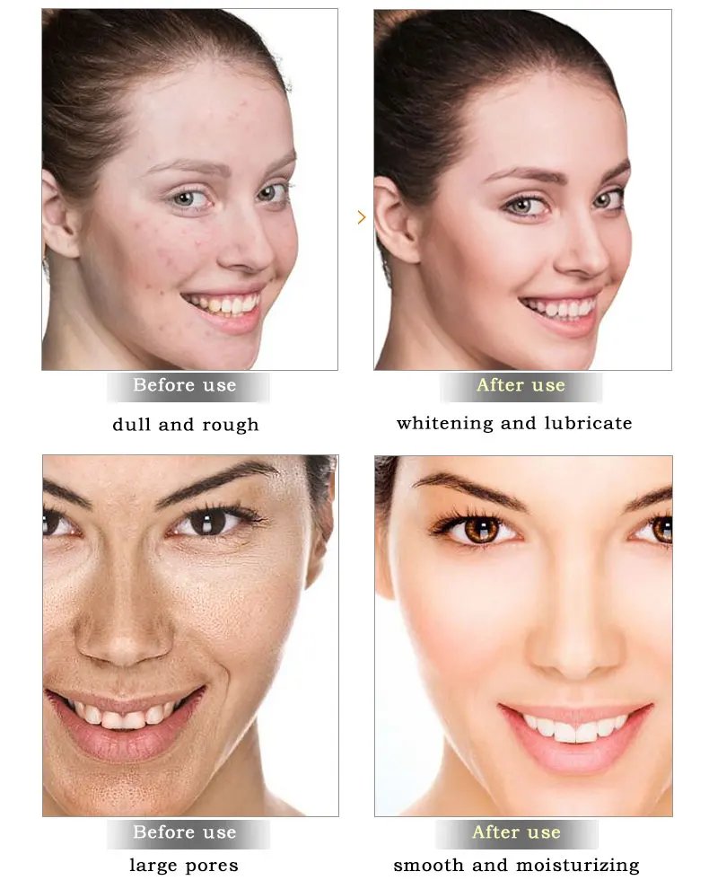 ARTISCARE Snail Face Cream + Peptide Eye Roller + Golden Eye Cream 3Pcs for Facial Moisturizing Serum Dark Circles Eye Care