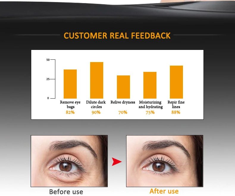 ARTISCARE Snail Face Cream + Peptide Eye Roller + Golden Eye Cream 3Pcs for Facial Moisturizing Serum Dark Circles Eye Care