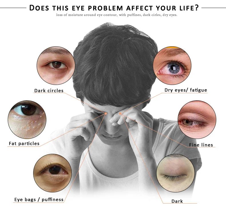 ARTISCARE Snail Face Cream + Peptide Eye Roller + Golden Eye Cream 3Pcs for Facial Moisturizing Serum Dark Circles Eye Care