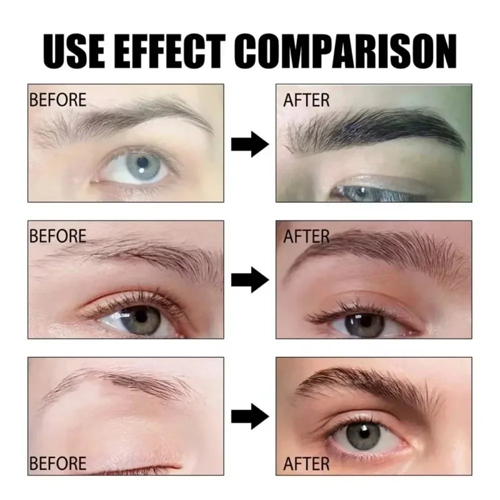 Eyebrow Growth Serum Eyelash Hair Growth Anti Hairs Loss Product Prevent Baldness Fuller Thicker Lengthening Eyebrow Makeup 30ml Eyebrow Growth Serum Eyelash Hair Growth Anti Hairs Loss Product Prevent Baldness Fuller Thicker Lengthening Eyebrow Makeup 30ml