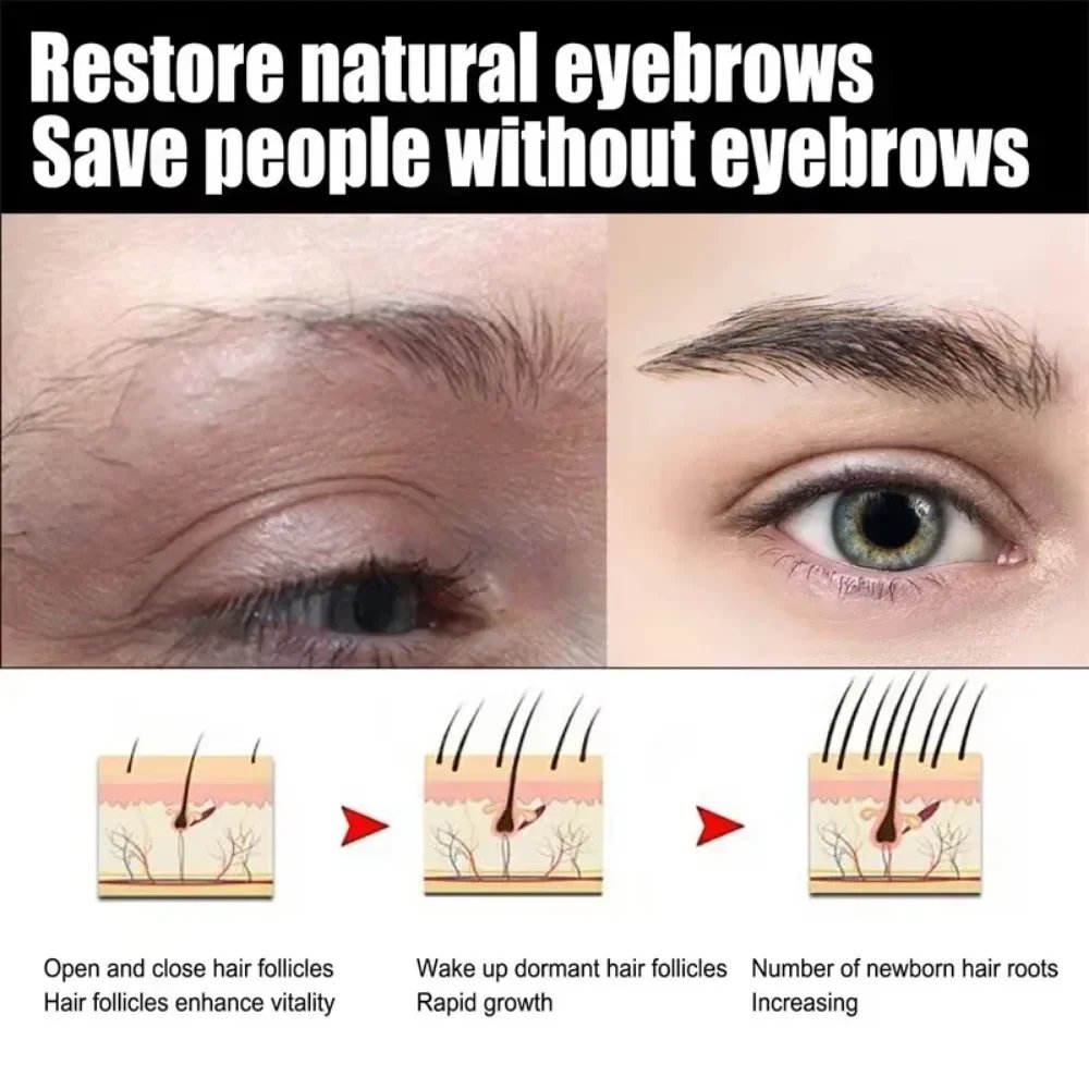 Eyebrow Growth Serum Eyelash Hair Growth Anti Hairs Loss Product Prevent Baldness Fuller Thicker Lengthening Eyebrow Makeup 30ml Eyebrow Growth Serum Eyelash Hair Growth Anti Hairs Loss Product Prevent Baldness Fuller Thicker Lengthening Eyebrow Makeup 30ml