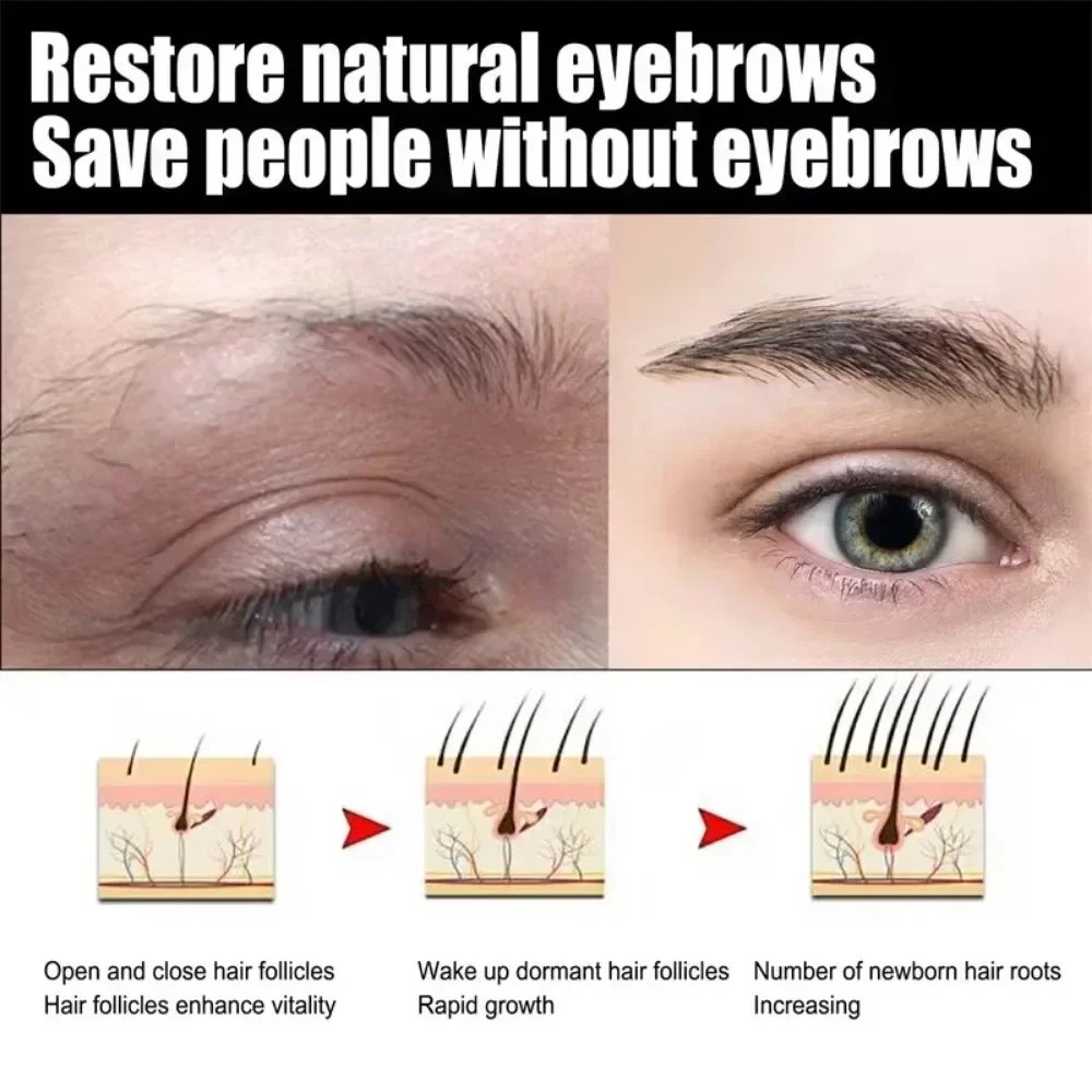 Eyebrow Growth Serum Eyelash Hair Growth Anti Hairs Loss Product Prevent Baldness Fuller Thicker Lengthening Eyebrow Makeup 30ml - Image 3