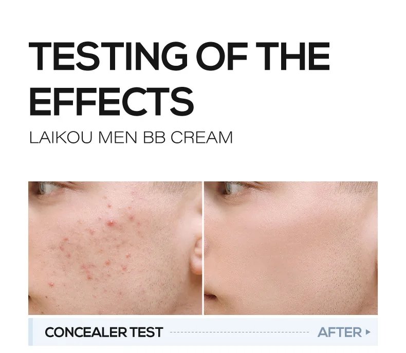 Crema BB blanqueadora para hombre, corrector con control de aceite, elimina pecas, ilumina la piel, fácil de usar, maquillaje cosmético, líquido Facial